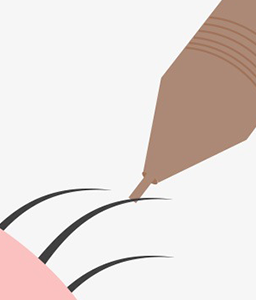 피부속의 모낭을 피부조직과 분리시키는 이미지