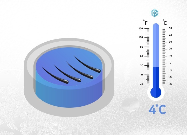 저온 모낭이식 설명하는 그림